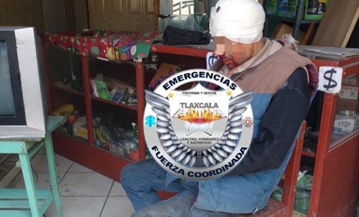 Agreden a hombre con un cincel en la cabeza en Huamantla