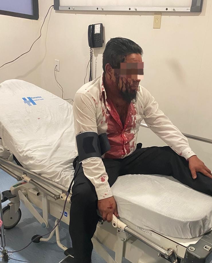 Asaltan con violencia a chofer de unidad de transporte público de la ruta Miraflores en Tlaxcala