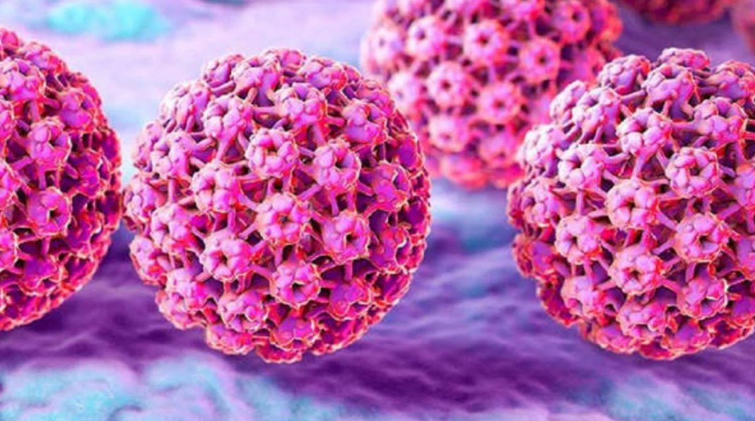 ¿El VPH se puede curar o solo se puede controlar?