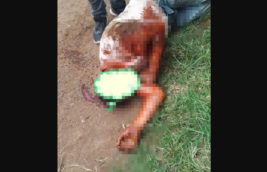 Hombre resulta gravemente herido por ataque de pitbull en Zacatlán