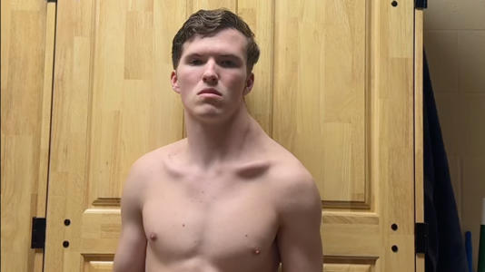 El reto absurdo de un adolescente se vuelve viral: su cuerpo es irreconocible