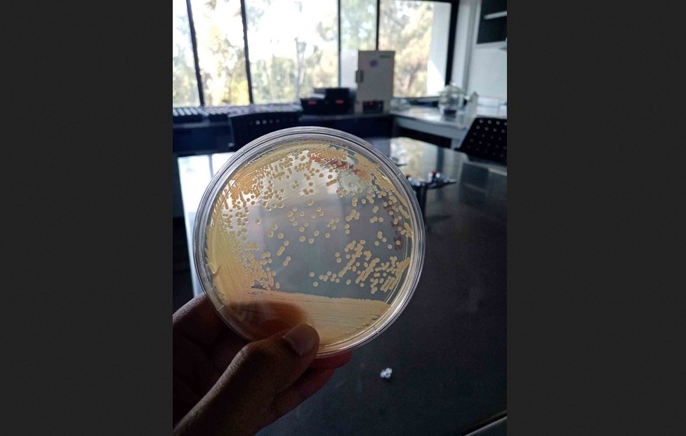 Microbios que desafían la contaminación del Río Santiago