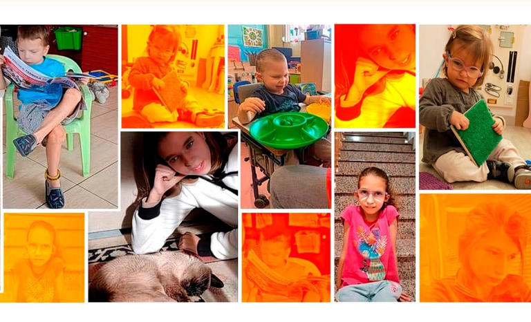 ¿Qué es el Síndrome DYRK1A?; conoce sus principales síntomas