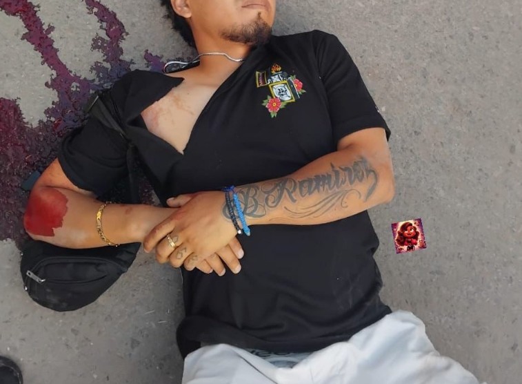 Adolescente herido en violento asalto