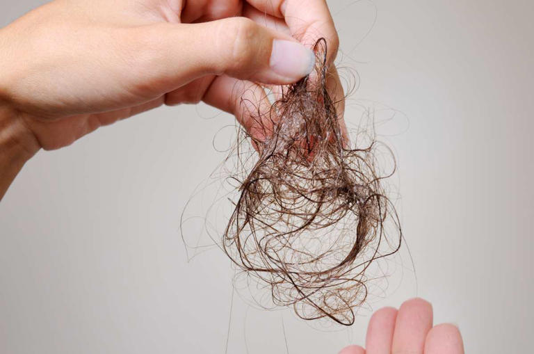 La pérdida del cabello, su impacto y cómo recuperar lo perdido