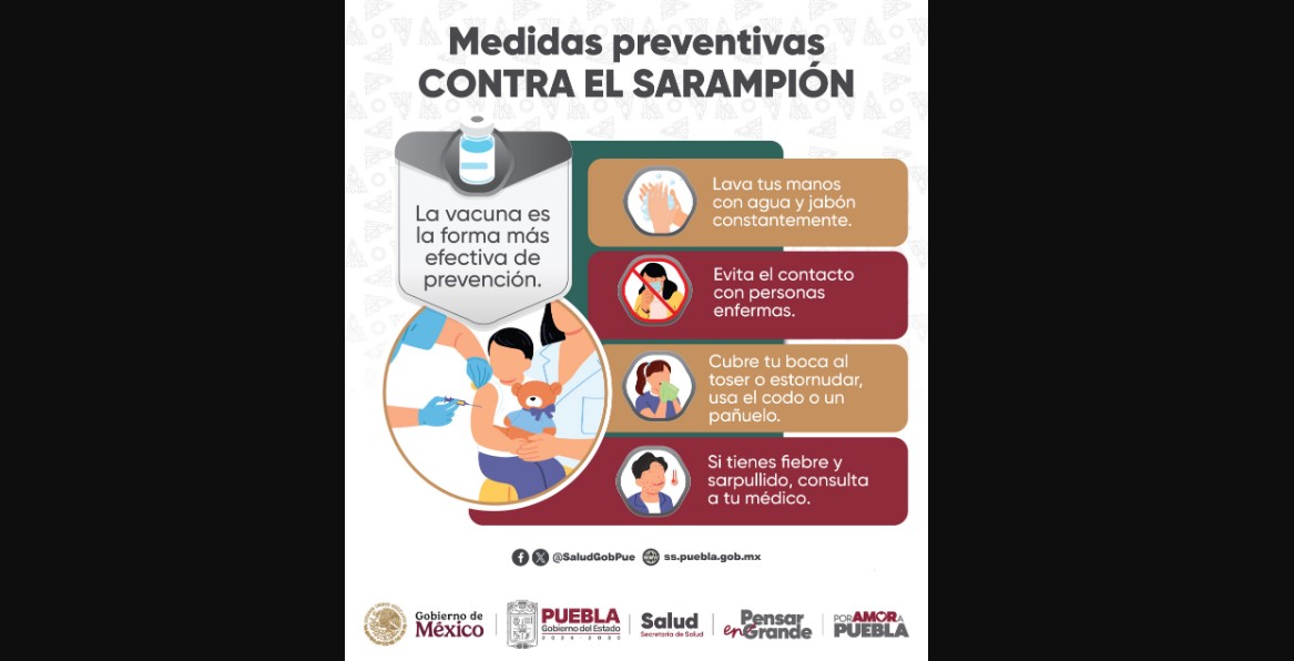 Detectan primer caso de sarampión en Puebla