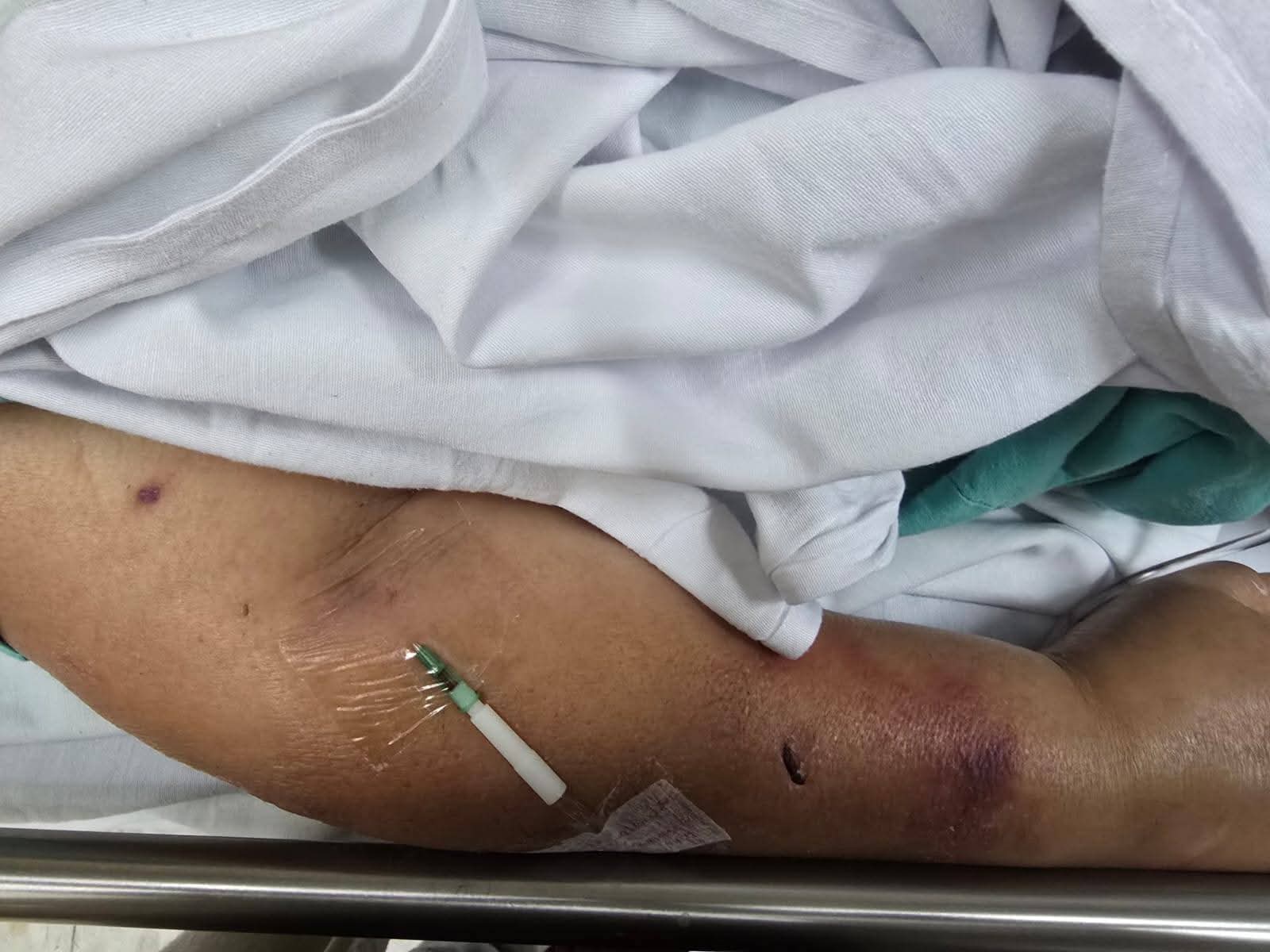 Crisis en el IMSS Tlaxcala: Denuncian negligencia médica contra Adulta Mayor