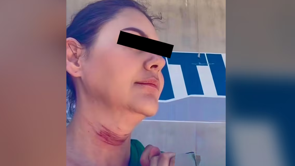 Mujer denuncia en video las marcas de una cirugía estética