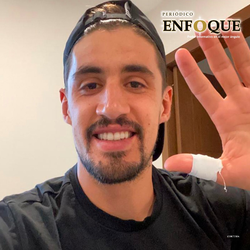 Se lesionó dedo de la mano y lo dan de baja de la #eLigaMX 