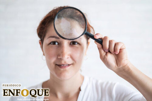 Manchas en la cara: causas, tipos y tratamientos