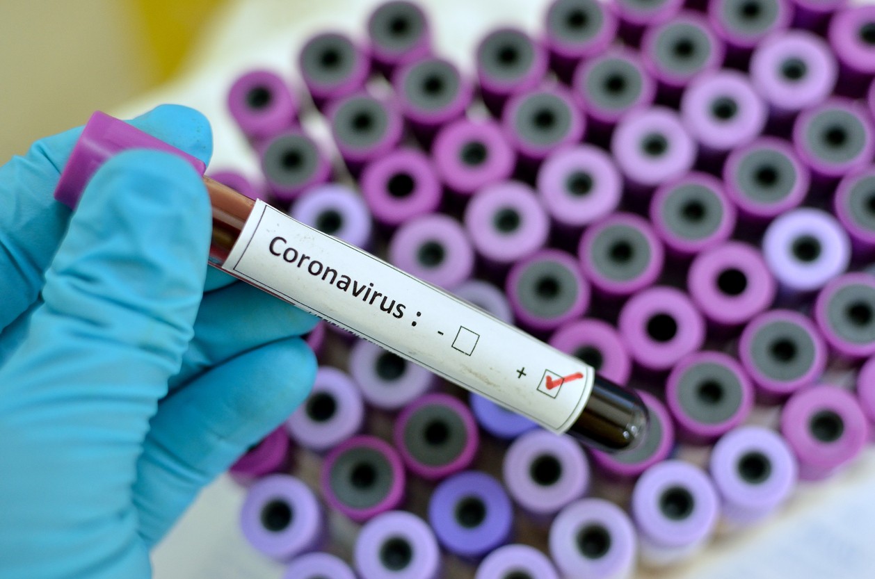 Profesor del IPN que viajó a China, posible portador del coronavirus en México