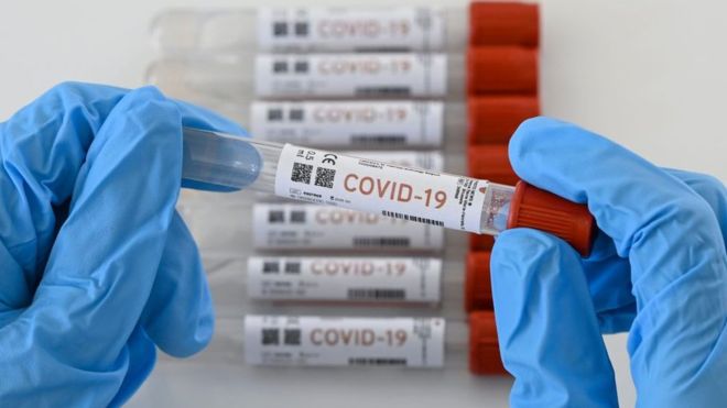 En México, el 50% de la pruebas de COVID-19 dan positivo; es la mayor tasa a nivel global