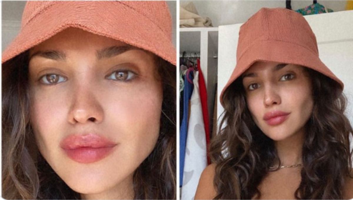 Eiza González se realiza nuevo retoque estético y le llueven críticas