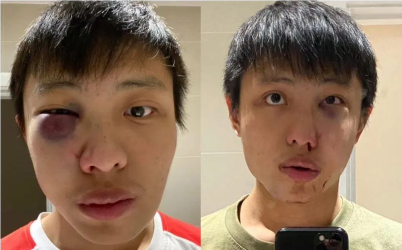 Estudiantes asiáticos son atacados brutalmente, “no quiero tu coronavirus”, les dijeron