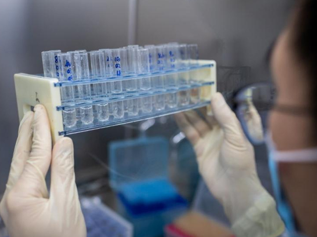 Desarrollan en Japón anticuerpo para combatir al nuevo coronavirus