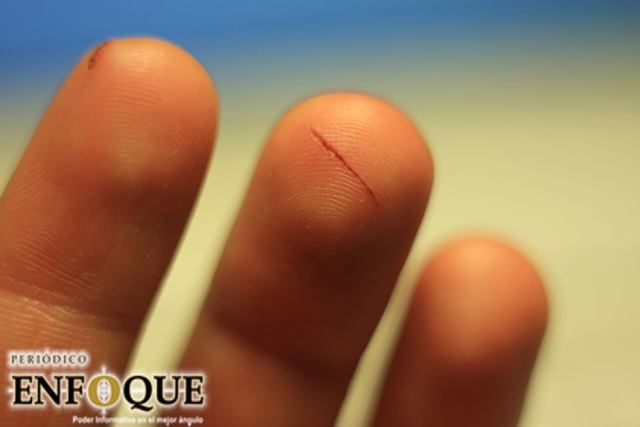 ¿Por qué cortarse con papel duele mucho?