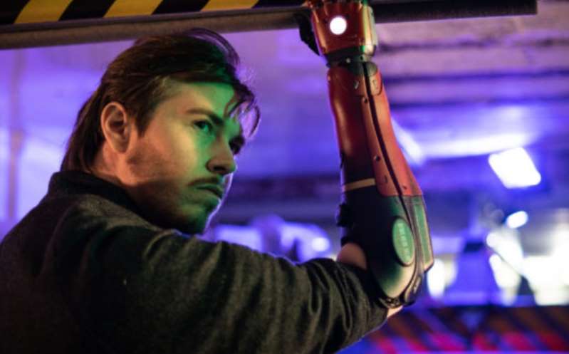 Hombre que nació con discapacidad ahora usa brazo biónico de 'Metal Gear Solid'