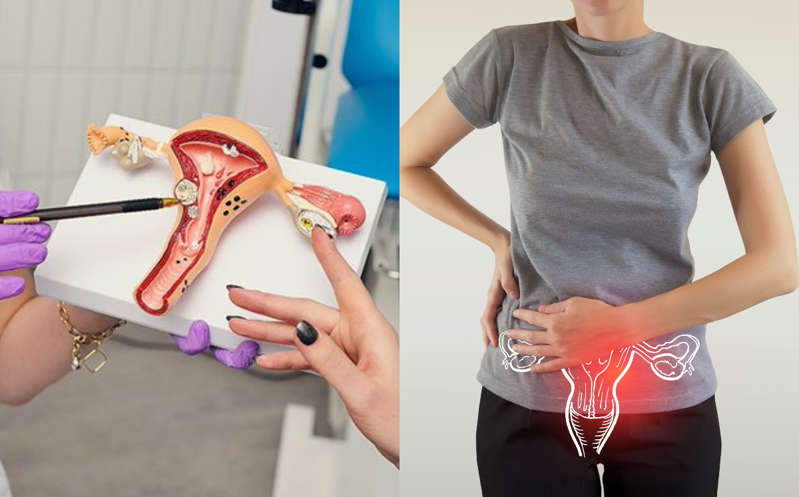 Incrementan casos de cáncer cervicouterino en mujeres de entre 25 y 35 años