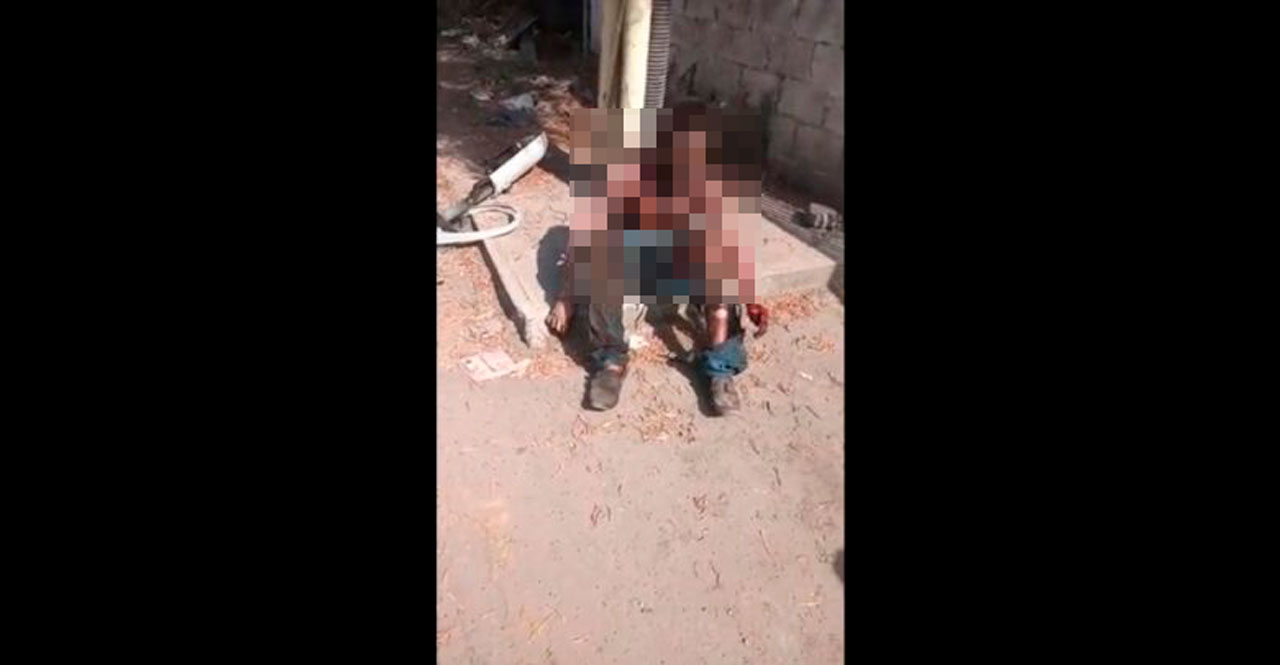 Hombre recibe descarga eléctrica de 7 mil 500 voltios tras intentar robar lámpara de alumbrado público en Puebla