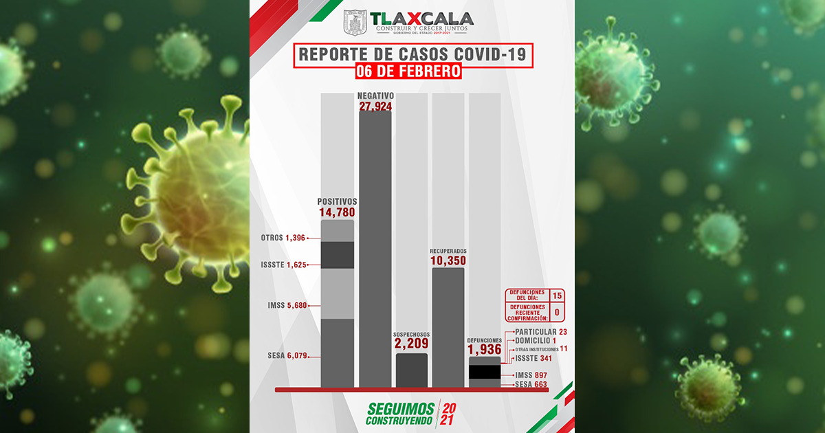 prensa 4