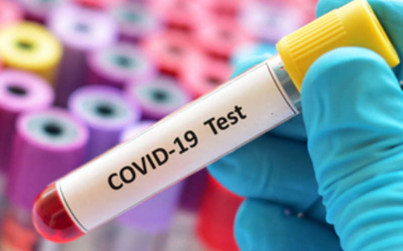 ¿Podrías contagiarte de covid-19 grave? Estudio de sangre podría dar respuesta