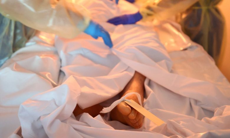 Muere hombre de caso sospechoso de “hongo negro” en CDMX