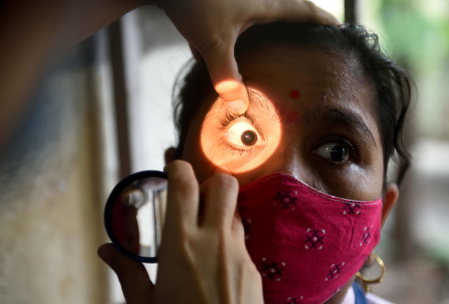 México registra primera muerte por mucormicosis, la enfermedad del ´Hongo Negro´