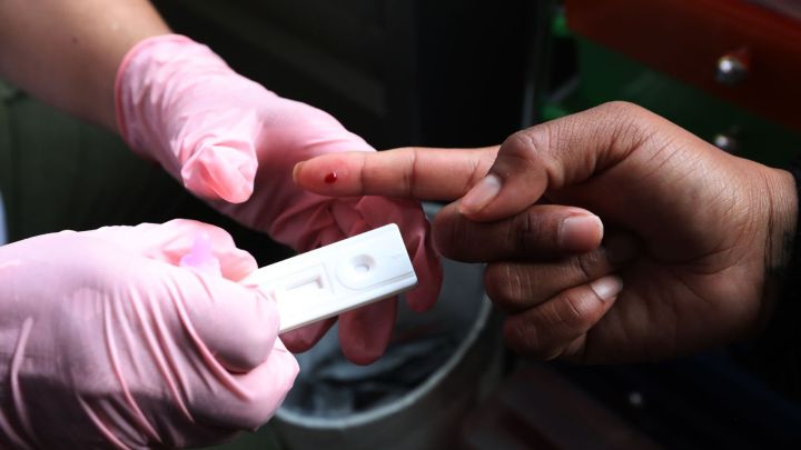 El sida no debe olvidarse por la actual emergencia sanitaria, en 2020 esta enfermedad dejó 680 mil muertes: ONU