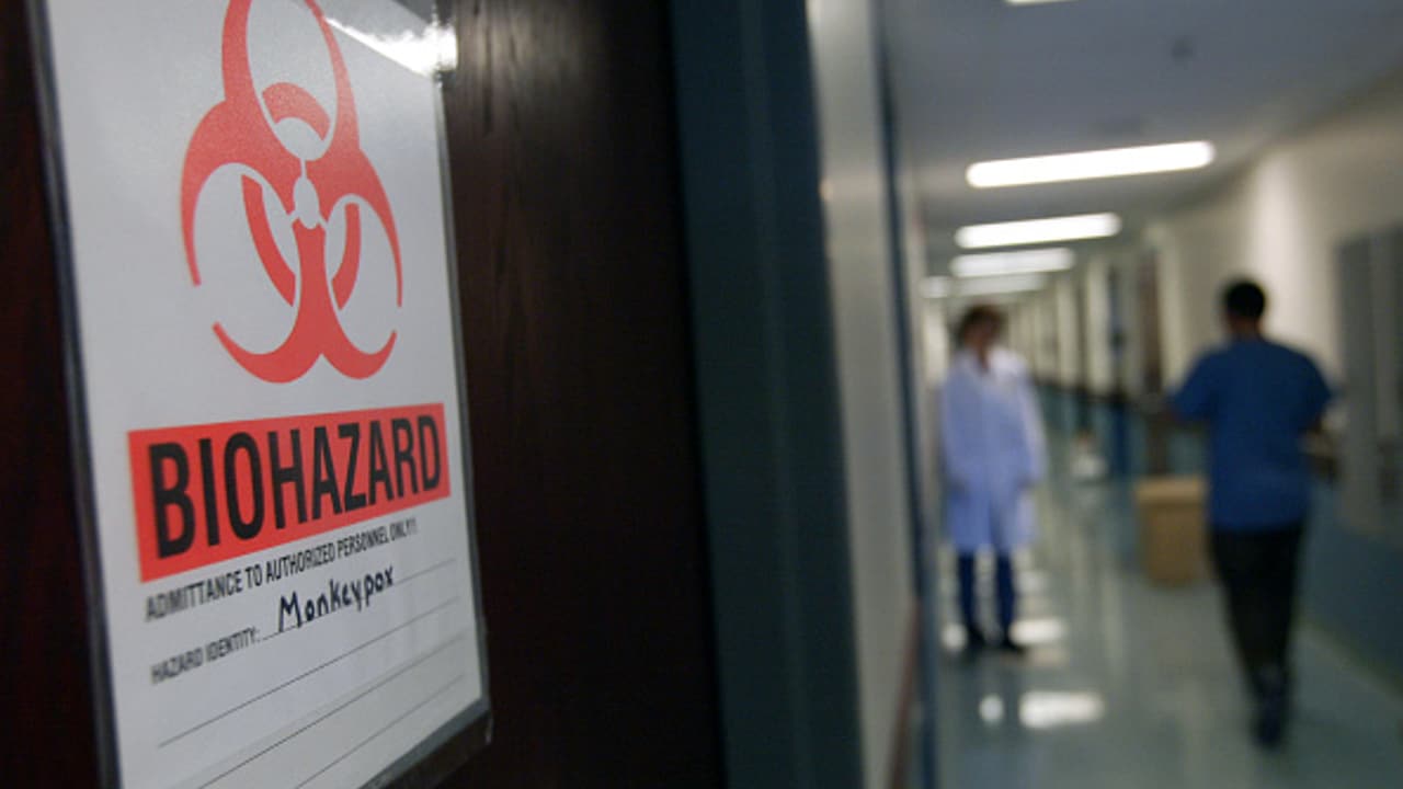 India y Perú confirman su primer deceso a causa de infección por viruela del mono