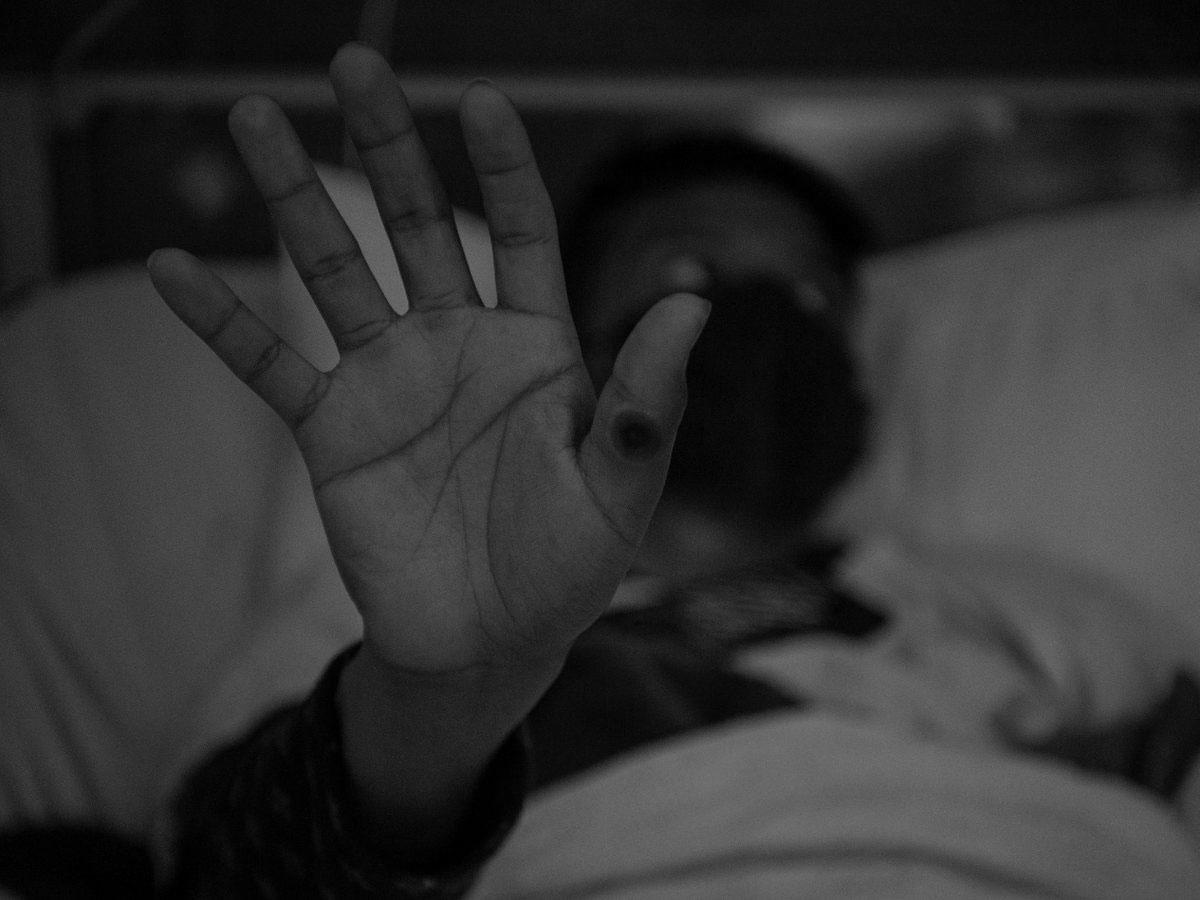 Fallece italiano de quien se reportó el primer caso de viruela símica en Cuba