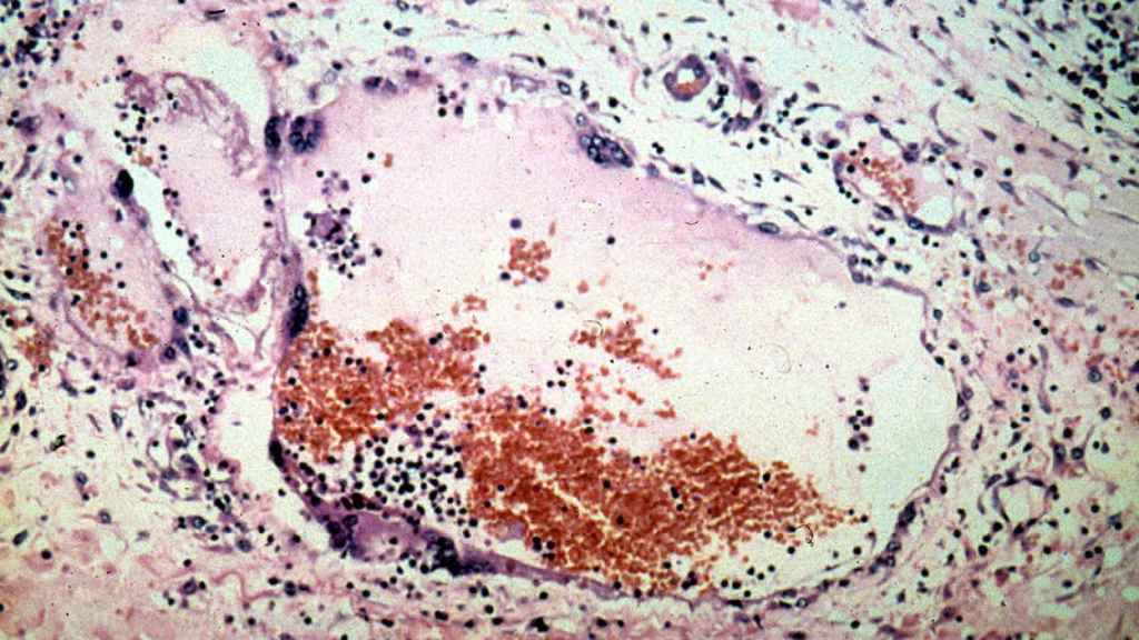 ¡Otro virus!: detectan en China 35 casos de henipavirus, un nuevo virus de origen animal