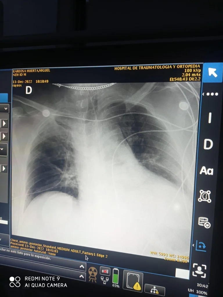 barbosa negligencia2