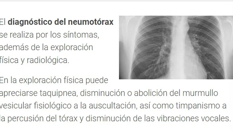 barbosa negligencia3