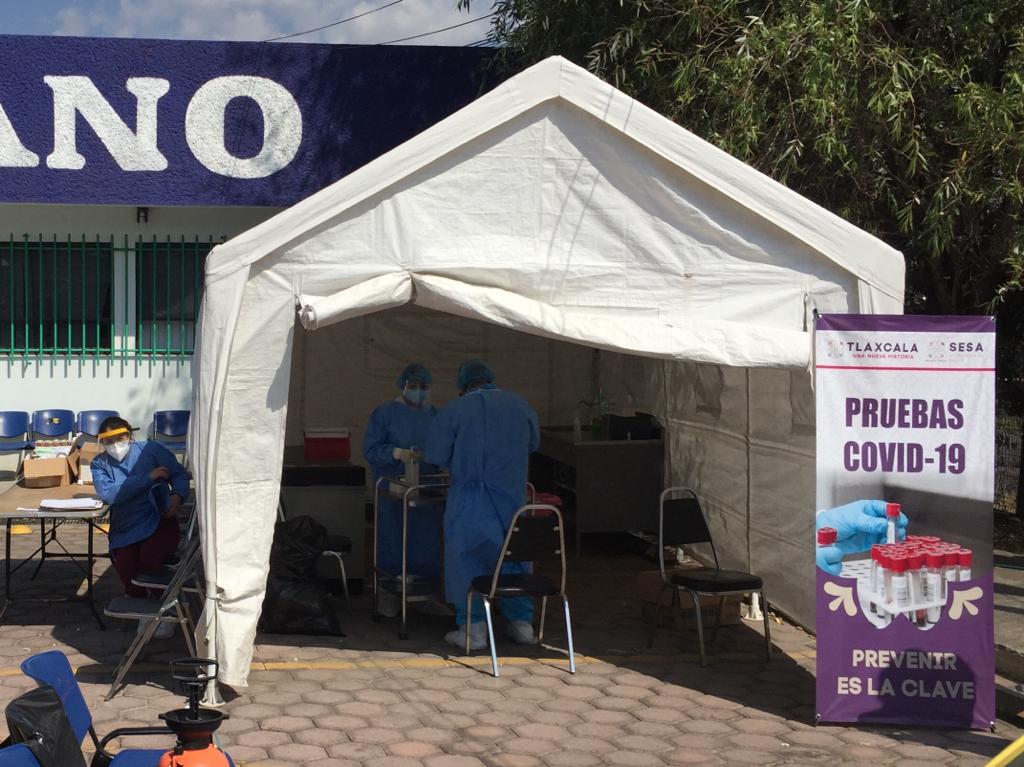 Sesa con pruebas suficientes para detectar casos de Covid-19