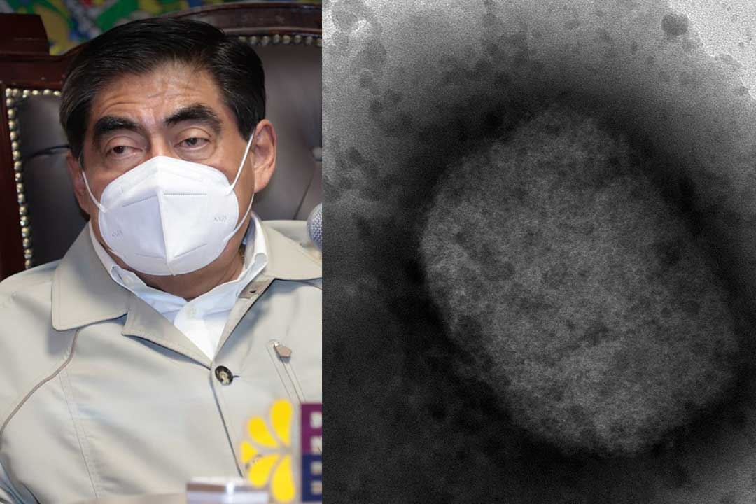 Puebla confirma sus dos primeros casos de viruela del mono