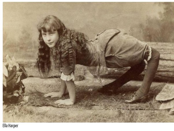 Ella Harper, esta es la conmovedora historia de "La niña camello"