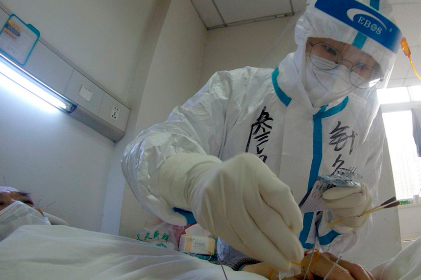 Autoridades en China incluyen la acupuntura en protocolo actualizado contra Covid-19
