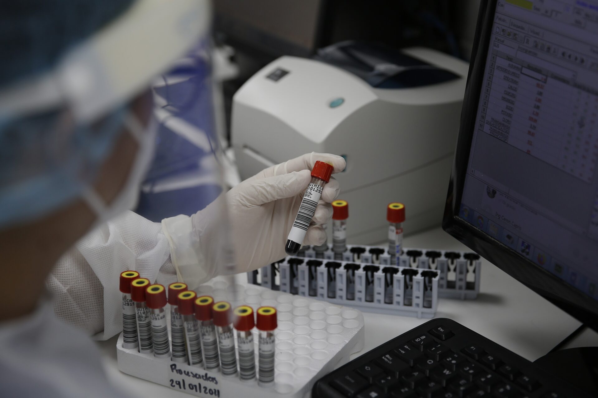 ¿Cómo se contagia la viruela del mono y cuáles son sus síntomas?