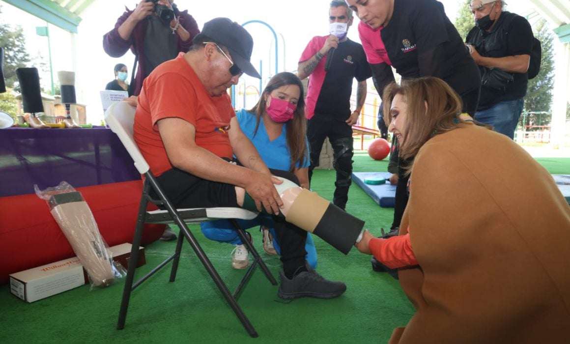 Entregó Lorena Cuéllar prótesis de pierna a personas con discapacidad
