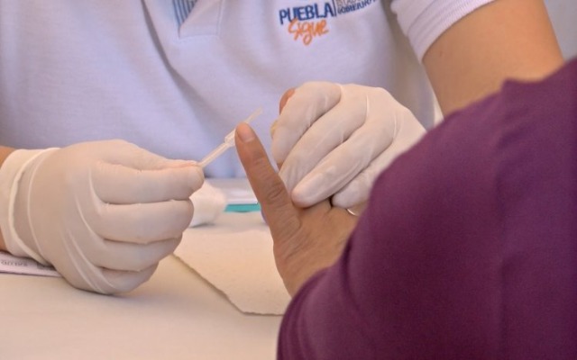 Secretaría de Salud brinda atención a más de 4 mil personas que viven con VIH en Puebla