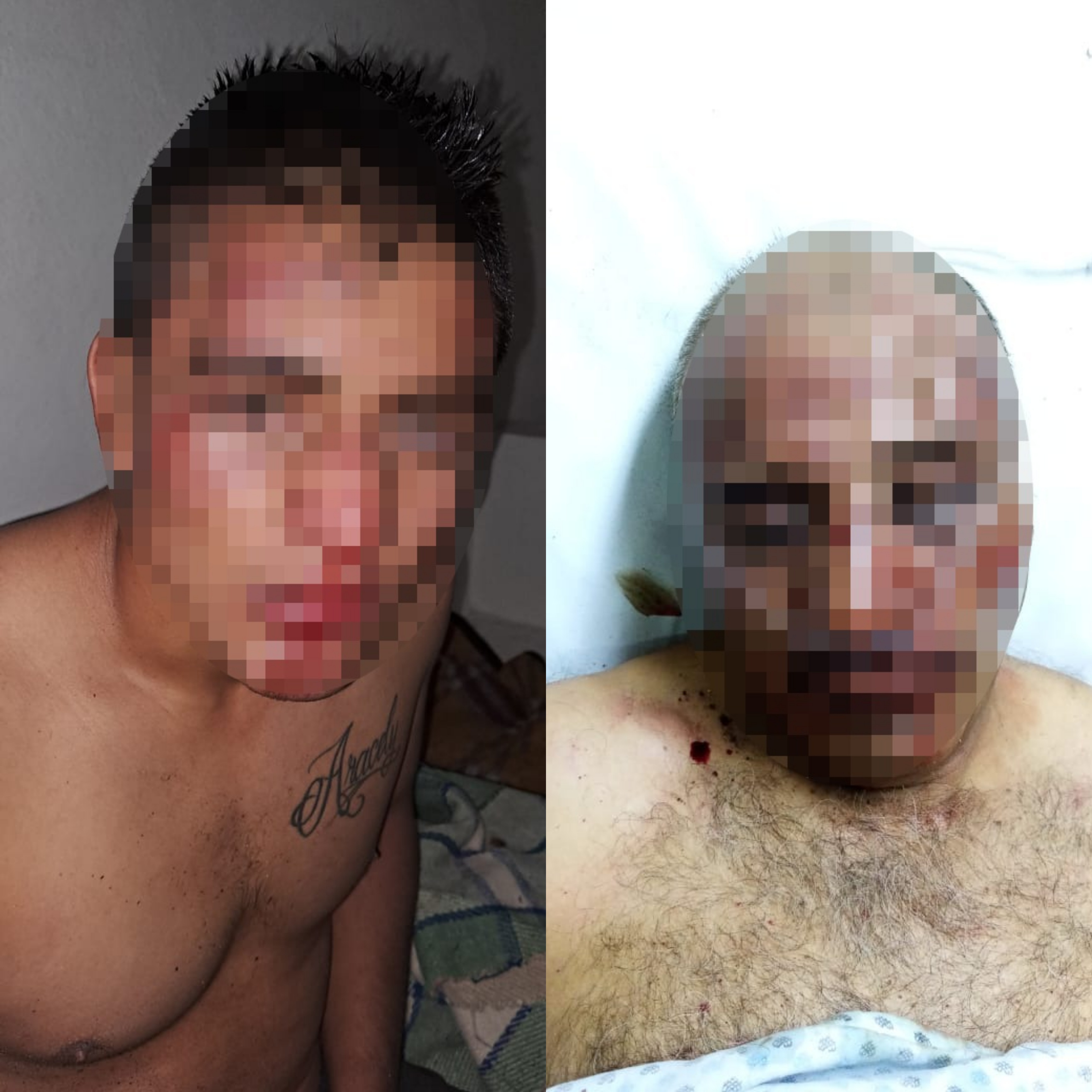 Par de ladrones se salvan de ser linchados; atracaron un consultorio médico, en Ayecac