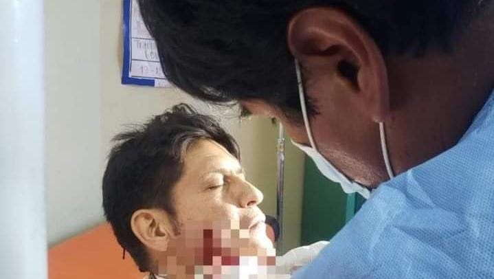 “El Zapata” salva la vida tras cirugía facial