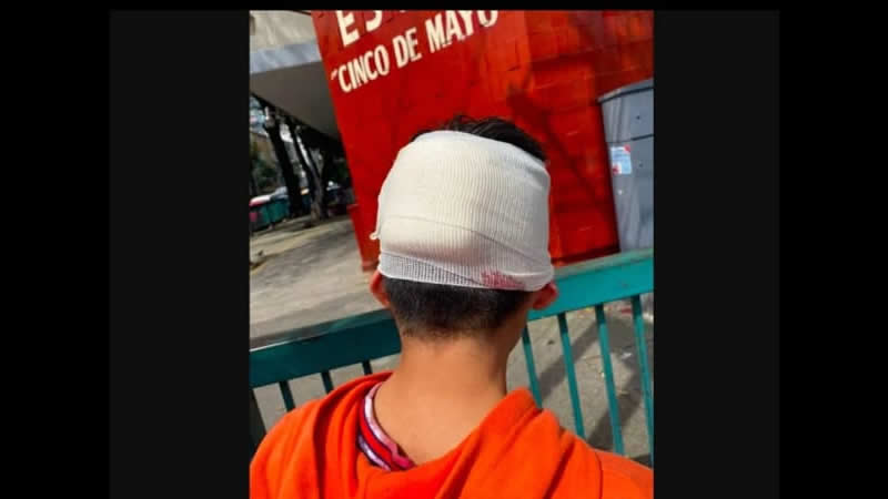 “Ellos me empujaron”: Niño apuñaló a compañero de secundaria con un desarmador