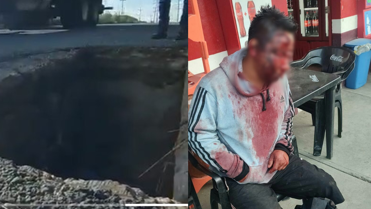 En Cuautlancingo; un ciclista resultó gravemente lesionado al caer en un registro sin tapa