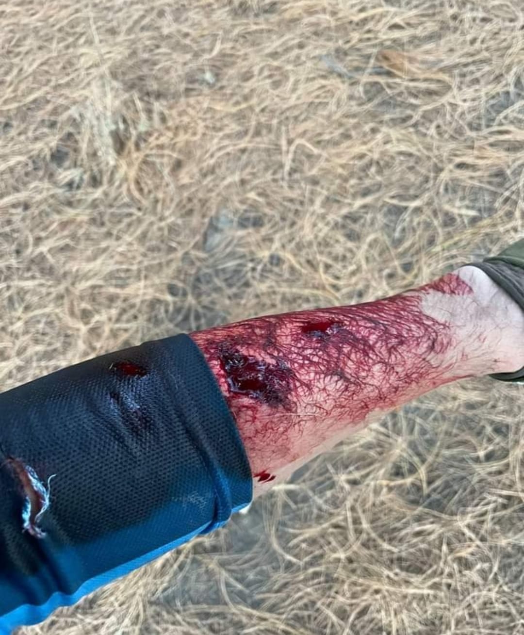 Solo un caso de ataque canino se tiene reportado en el cerro Zapotecas en lo que va de la administración