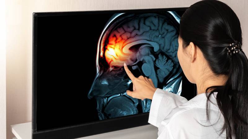 Meningitis en Durango: Detienen a anestesiólogo y otras dos personas por los contagios