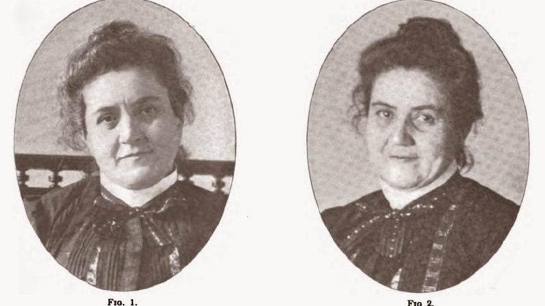 Jane toppann, la sádica enfermera que cometió 31 crímenes y terminó recluida en un hospital para dementes 