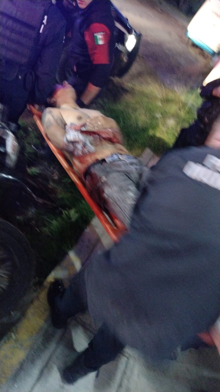 Motociclistas abren fuego en contra de un hombre y lo hieren gravemente, en Tetla