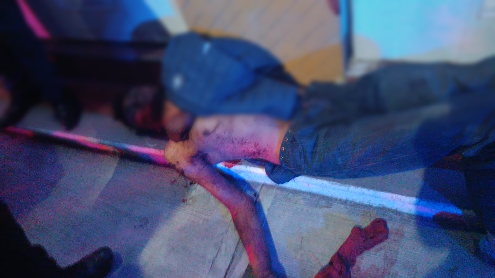 Apuñalan a hombre durante riña y lo abandonan a su suerte en Tenango, Tetlatlahuca