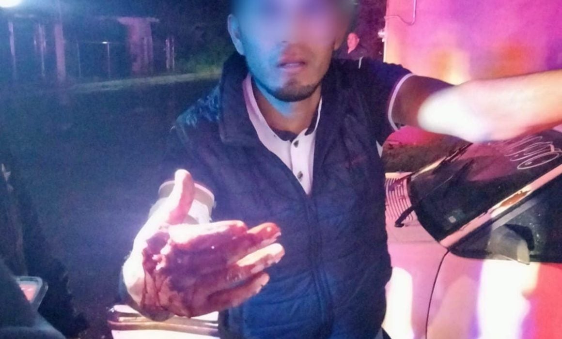 Hieren a hombre con disparos de escopeta en Panotla